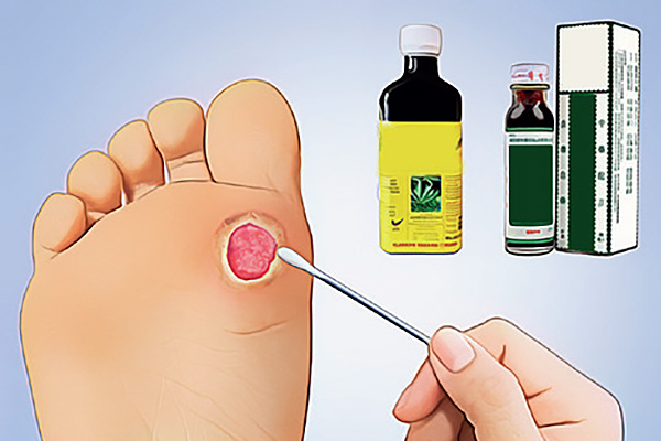 Diabetes Foot Care Tips to Avoid Foot Complications HealthXchange